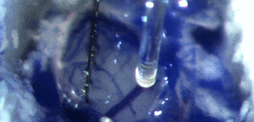 Chronic optrode assembly in action